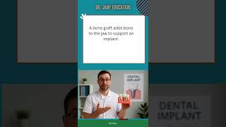 20  "What Are Dental Implants? Explained in 60 Seconds 🦷"