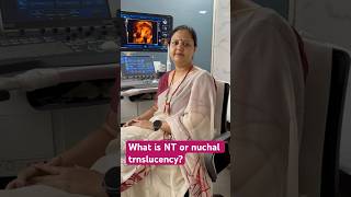 What is NT or nuchal translucency?