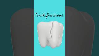Must-Know Dental Emergencies: What You Need to Understand" #dentistexplains #teeth#dental