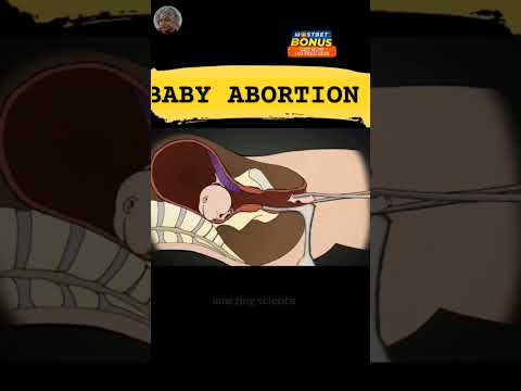 Baby Abortion 🥺 3D Animation Video #2023 #shorts #facts