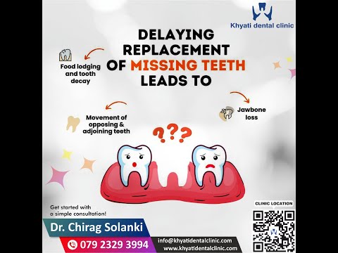 Immediate Implant