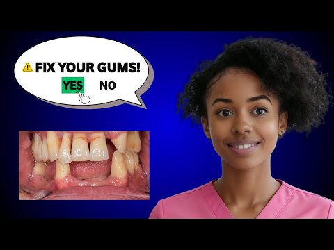 These 5 Foods Can Rebuild Your Receding Gums