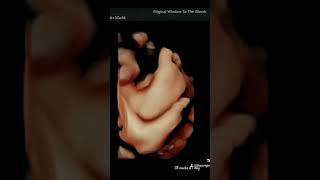 TINY FEET 35 weeks & 1 day 4D 👶  BABYSCAN #baby #4dscan #babyscan #babyboy #hdlive #love #babygirl