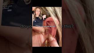 Do *THIS* to TREAT & PREVENT ear blackheads #acne #acnetreatment #dermatology #salicylicacid