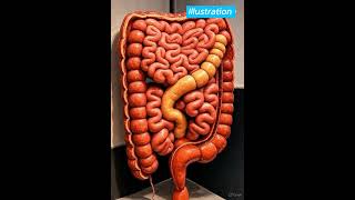 What Happens Inside the Colon During Constipation? | 3D Medical Animation #shorts