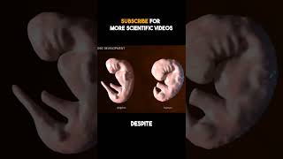 The Developmental Similarity Between Human and Dolphin Embryos