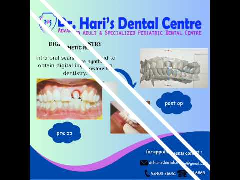 #whatsnew #bestkidsdentalclinicinchennai#bestdentalclinicforkids#pediatricdentalclinic#kidsdental