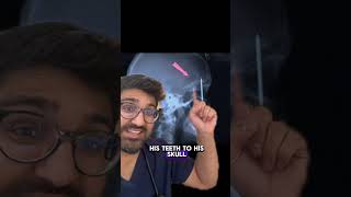 Doctor REACTS to RARE X-ray #health #xray #construction #healthandsafety #toothache #nailgun