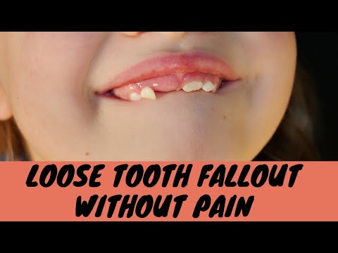 loose tooth fallout without pulling it at home||loose tooth fallout