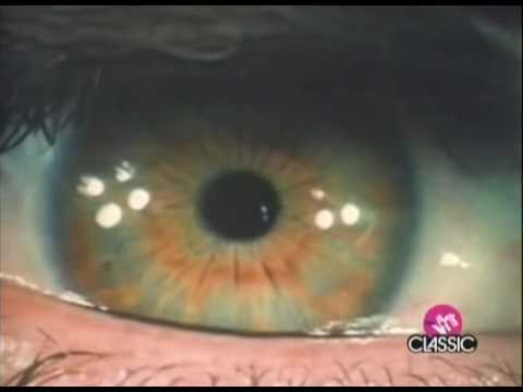 Pink Floyd - Brain Damage Music Video
