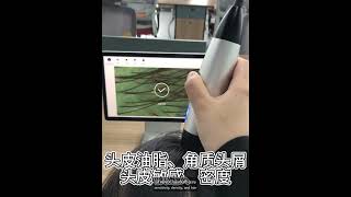 💡 How This AI Scalp Analyzer is Helping Hair & Scalp Spas Boost Sales Instantly!