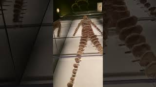 A Real Human Body Disected Into Fragments - Bodies Exhibit Luxor Las Vegas