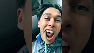 Never go to a Gen Z dentist… ​⁠@tylervitelli4  #relatablestories #comedy #funnymemes