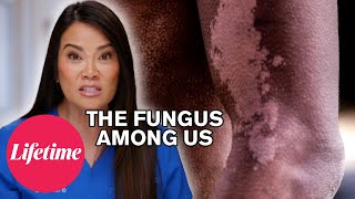 Dr. Lee Treats Carter’s Stubborn Rash | Dr. Pimple Popper: Breaking Out (S1) | Lifetime