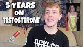 FTM: 5 YEARS ON TESTOSTERONE TIMELINE COMPARISON