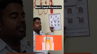 Root Canal Procedure #rootcanaltreatment  #dentaltreatment  #rootcanalspecialist #rootcanals