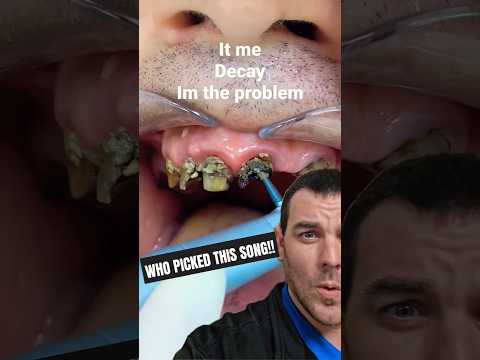 It's me, hi! I'm the problem, it's me! #toothdecay #dentist #decay #shorts