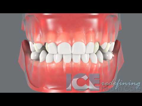 Dental Development (Center View)