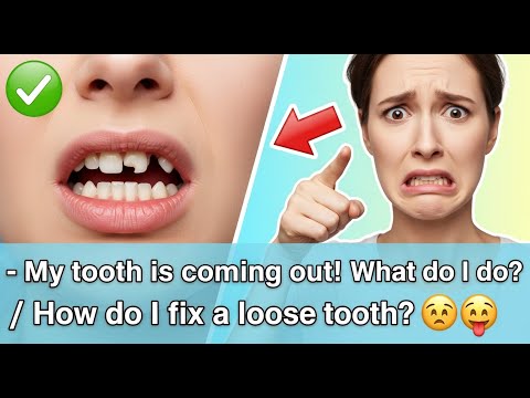 ✅ My tooth is coming out! What do I do? / How do I fix a loose tooth? 👈😳