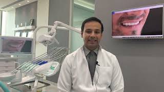Smile Enhancement 😃🤭| #dentalcare #teeth #smiledesign #dentist #smile #porcelainveneers #veneers