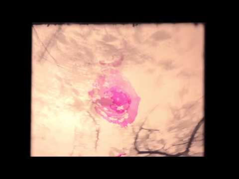 Disorientation (2011)