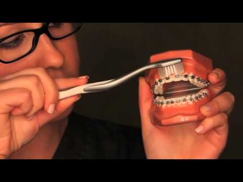 Brushing and Flossing with Braces