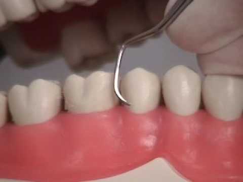 13Video BH5 6 Post Close1