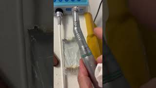 M4 Safety Handpiece is a formidable weapon in endodontics. #dentists #rootcanal #endodontist #teeth