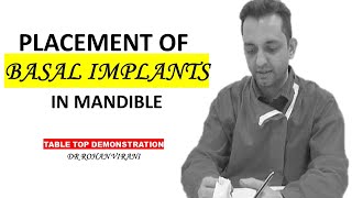 BASAL DENTAL IMPLANT PROCEDURE  OF IMPLANT PLACEMENT- ADVANTAGES|DISADVANTAGES HOW TO ENGLISH 2021