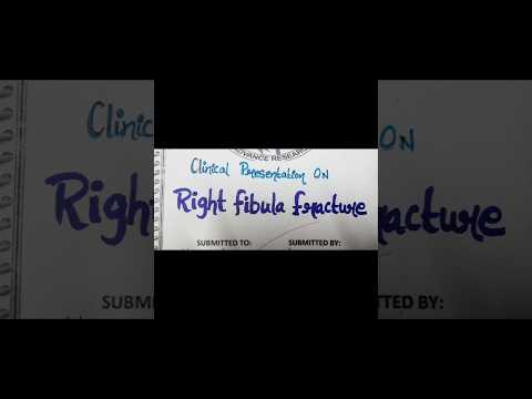 Case presentation on Right fibula fracture/clinical presentation #casepresentation #ncp #casestudy