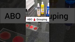 ABO blood grouping- MBBS Pathology Practical- Blood typing🩸 or Blood Grouping🩸 step by step #shorts