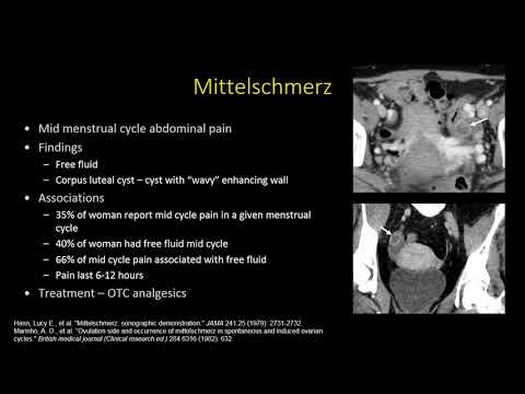 Common Benign Gynecologic Conditions