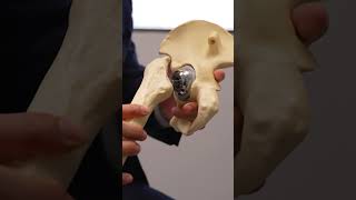 Applying For An #Orthopedic Fellowship? What To Know