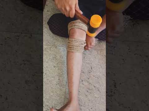 #bonesetting #jointpain #hamer #treatment