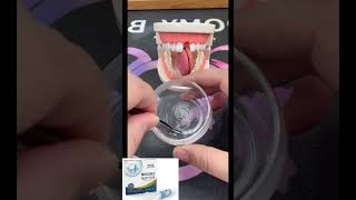 Fix your smile fast! Easy-to-use moldable tooth kit for temporary repairs at home #tooth #filling