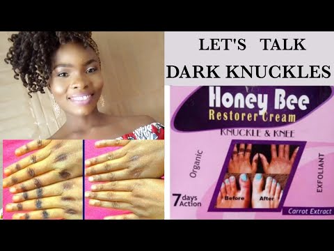 How to treat dark knuckles in 2020. With Honey Bee Restorer cream. #treatdarkknuckles