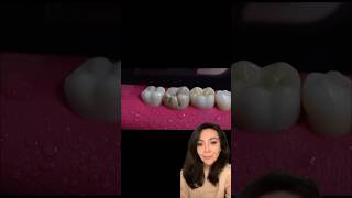 What Happens When you Need A Root Canal Treatment?!