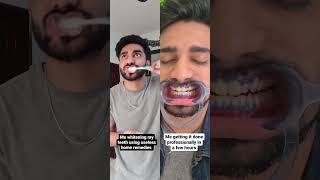 Sabka dentist recommends our revolutionary Teeth Cleaning & Whitening treatment for Strong teeth