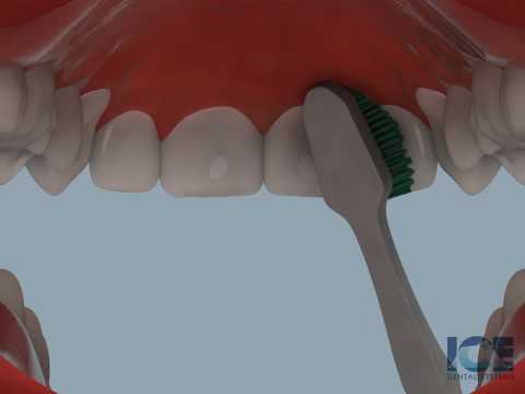 Brushing Upper Teeth