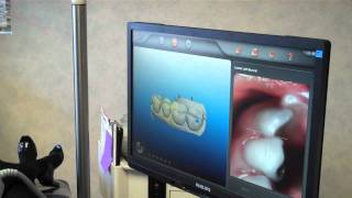 Revolutionizing Orthodontic Treatment: Introducing Our State-Of-The-Art Digital Impression Scanner