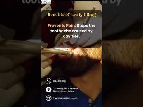 #cavityfilling #cavityprevention #cavityfree  #dentalclinic #jaipur #dentist #dentalcare
