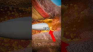 Stop Using Q-Tips Like THIS! 😱 #shorts