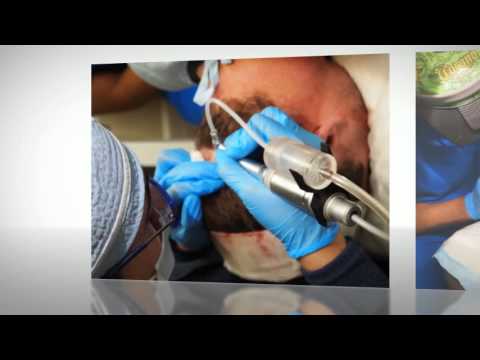 Pennsylvania FUE Hair Transplant/Restoration/Replacement