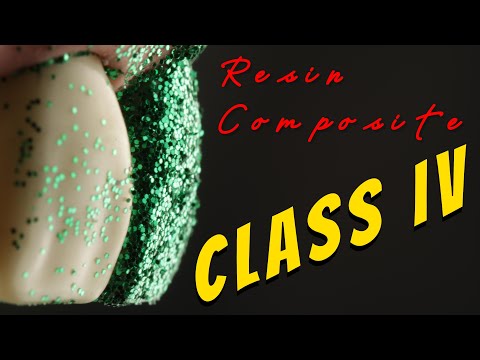 Composite class IV 4 step-by-step guide! 4K