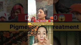 Pigmentation Treatment at  🏠 #pigmentation #pigmentationsolution #skincare #shortvideo #challenge