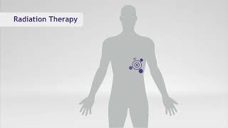 What's the Difference Between Chemo and Radiation? | SERO