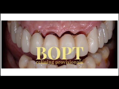 BOPT Provisional Relining - HOW TO