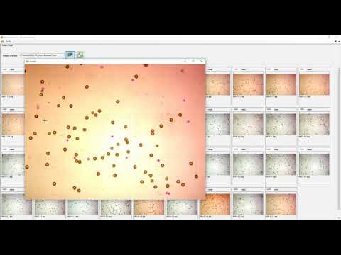 Photomeasure (Pollen Viability - HYRBEAN)