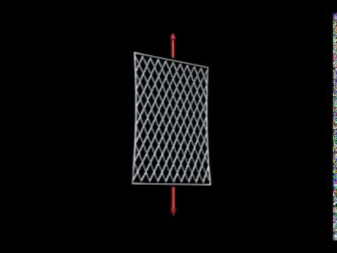 Tension Grid