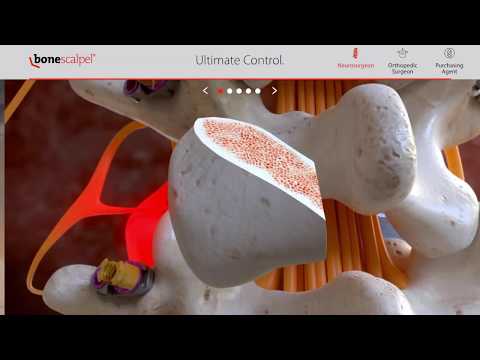 Mobile App Development Demo Reel - Infuse